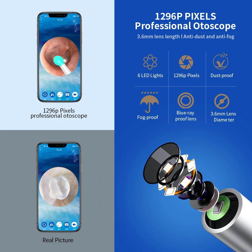 NE3 귀 청소기 카메라와 함께 고정밀 귀 왁스 제거 도구 LED 빛 무선 Otoscope 스마트 귀 청소 키트 최고의 선물