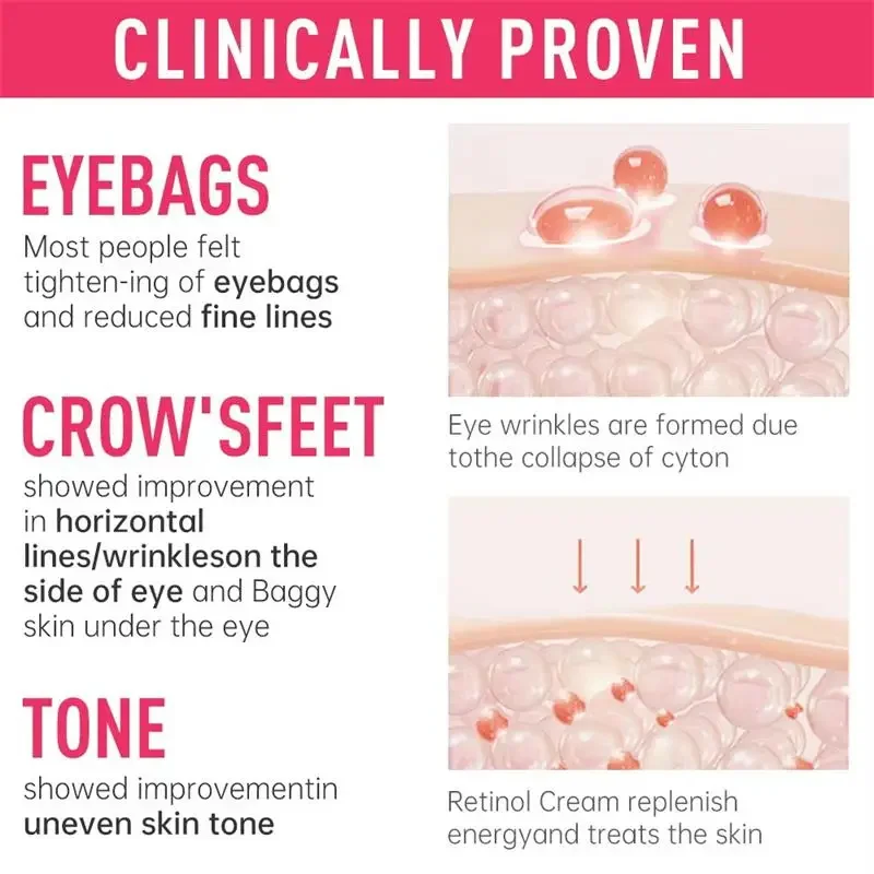 아이 백 제거 크림 콜라겐 주름 방지 페이드 파인 라인 퍼밍 스킨 안티 다크 서클 붓기 브라이트 아이 케어