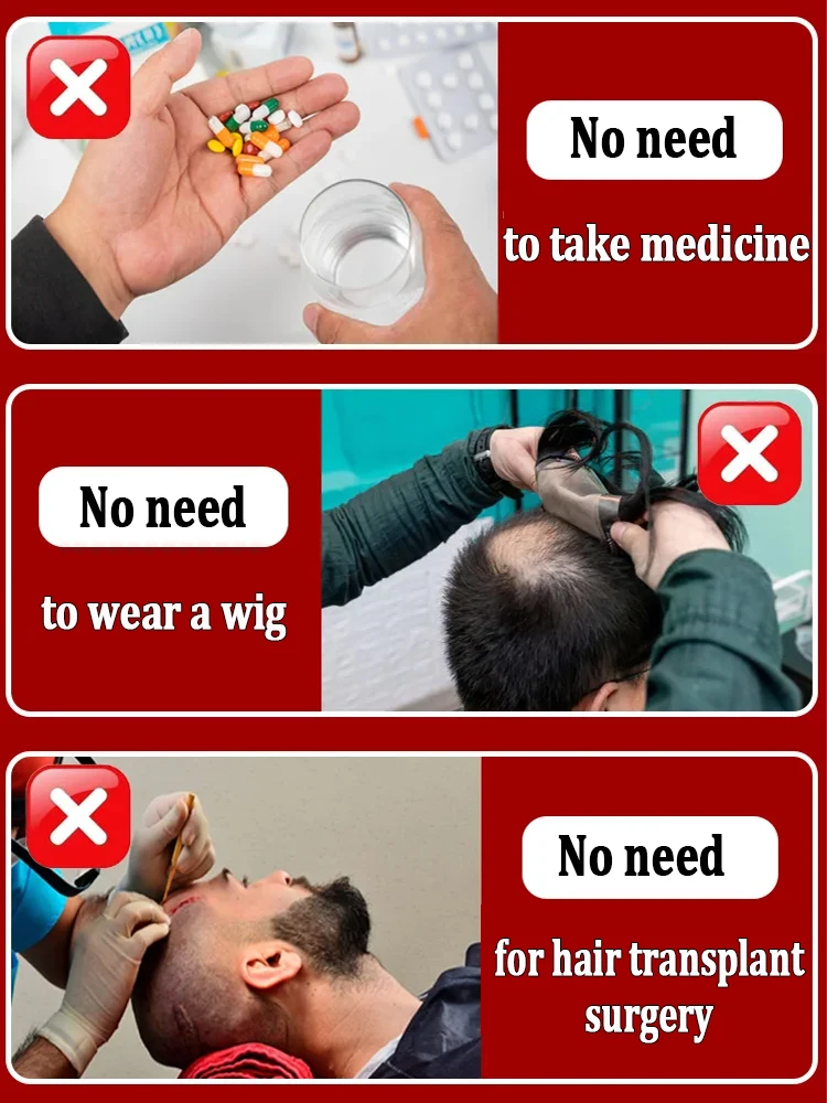 얇아지는 머리카락은 더 이상 문제가 아닙니다. 저희 헤어 성장 제품을 선택해 더욱 두껍고 튼튼한 머리카락을 만들어 보세요.